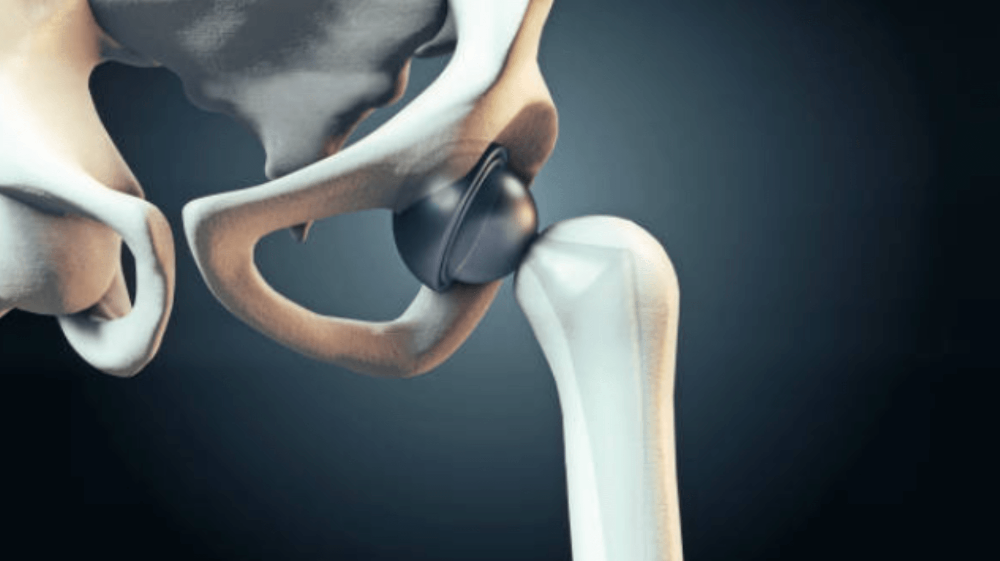 Fizjoterapia sportowa